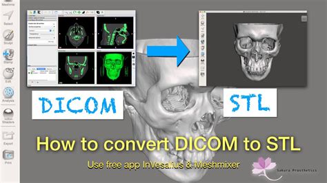 dicom to stl|dicom to stl converter software.